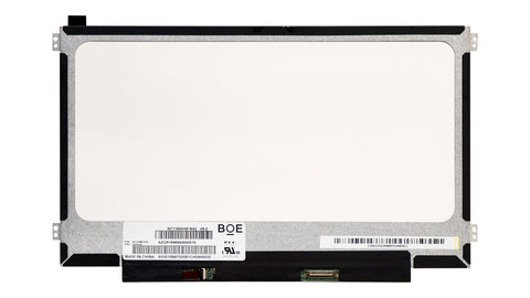 HP Chromebook 11 G5 EE Replacement Screen - Screen Surgeons